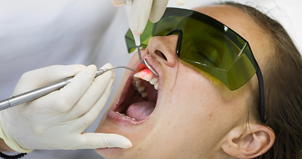lasertherapy 1030x544 1