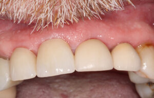 After Image: Crowns